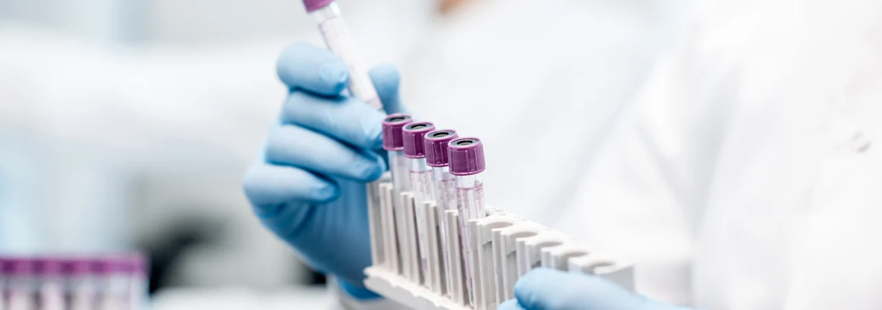 Gloved hands holding test tubes with purple caps, placing them into a white rack in a laboratory setting.